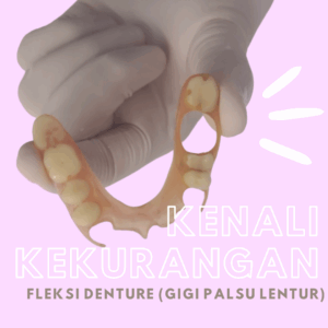 dokter gigi antapani - Kenali Kekurangan Fleksi Denture
